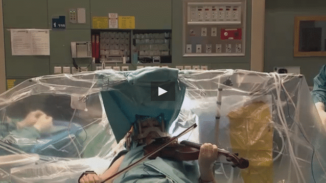 israele,violinista operata al cervello suona durante intervento