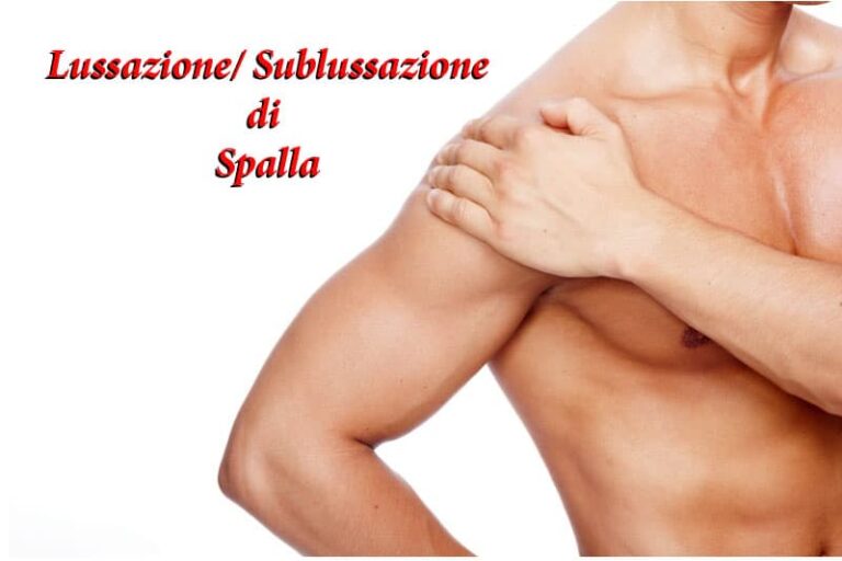 Sublussazione lussazione spalla, un dolore acuto