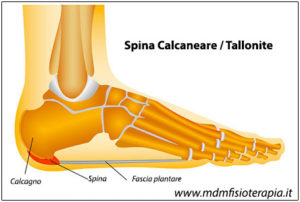 tallonite_spina-calcaneare