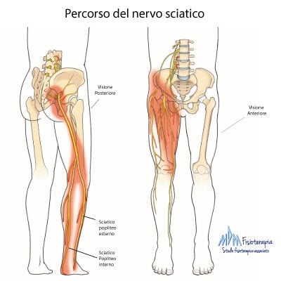 percorso nervo sciatico