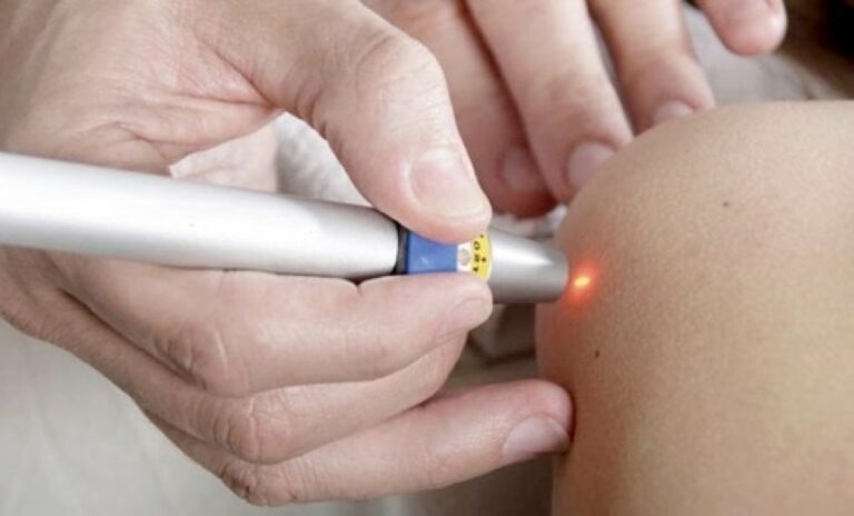 Laserterapia, una nuova arma contro le infiammazioni