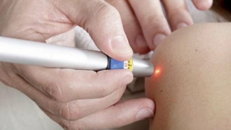 Laserterapia, una nuova arma contro le infiammazioni