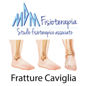 fratture caviglia