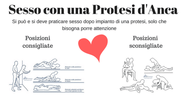 Sesso con una Protesi d'Anca