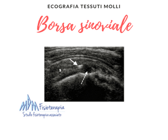 Ecografia tessuti molli