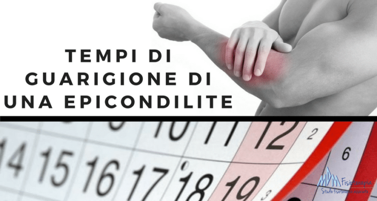 Tempi di guarigione Epicondilite  | Capire perchè non passa