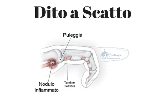 Dito a Scatto