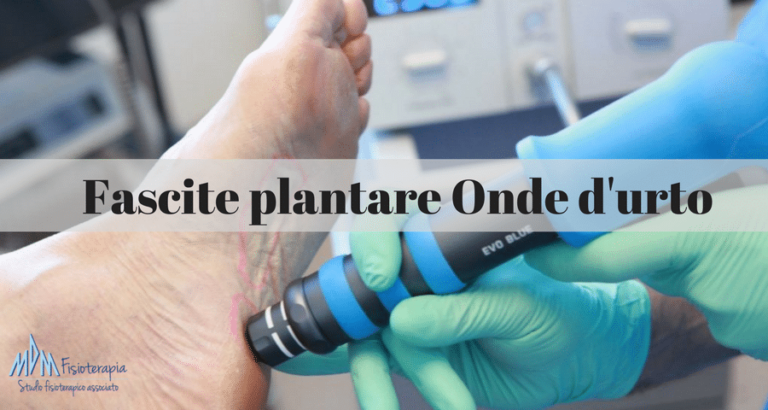 Fascite plantare onde d’urto