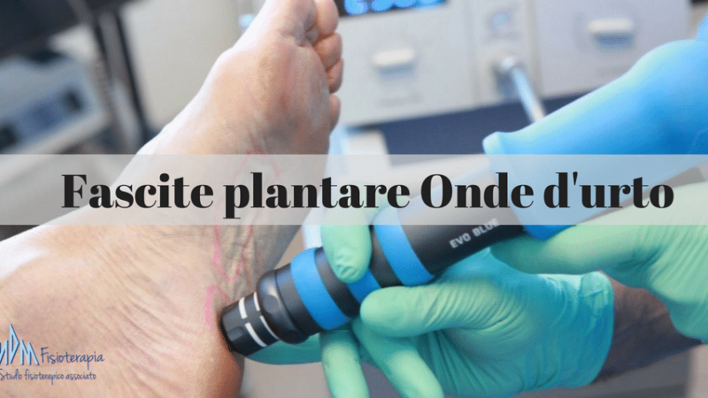 Fascite plantare onde d’urto