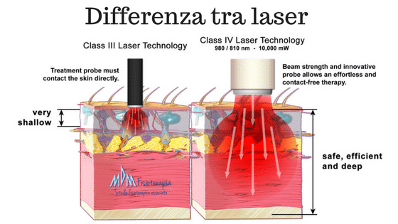 Differenza tra laser