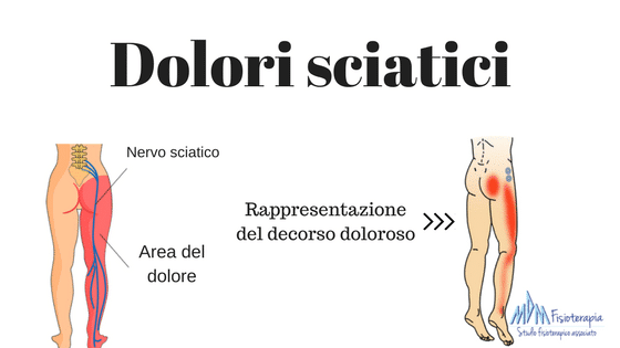 Dolori Sciatici  La guida completa per guarire definitivamente