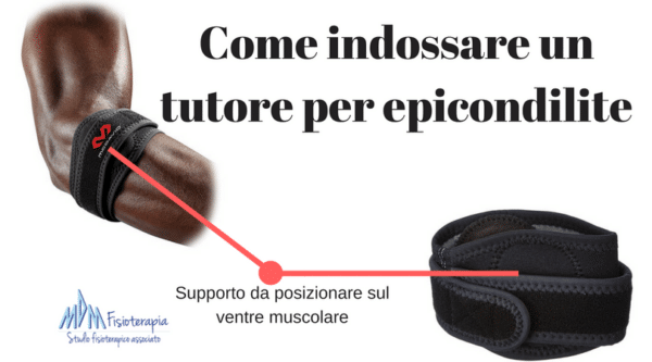 Come indossare un tutore per epicondilite