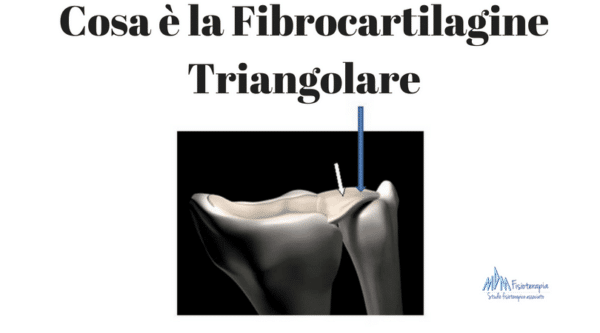 Cosa è la Fibrocartilagine Triangolare