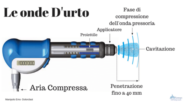 Differenza tra onde d'urto focali e onde d'urto radiali