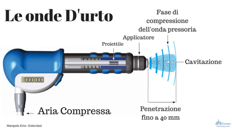 onde d'urto come funzionano