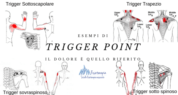 esempio di trigger point per dolore scapola