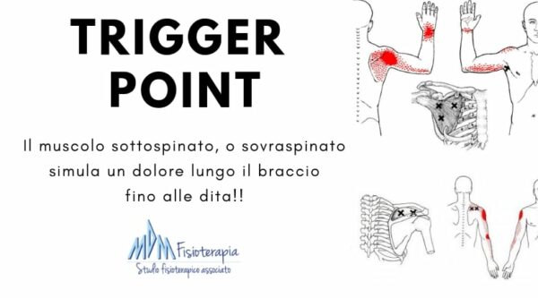 trigger point smartphonite