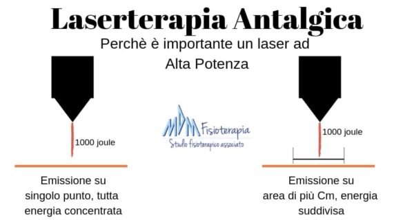 laserterapia antalgica ad alta potenza