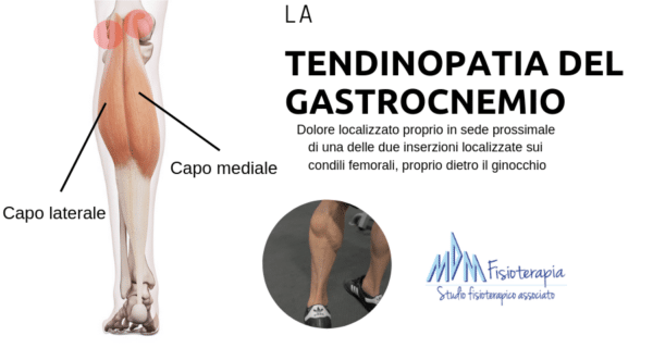 Tendinopatia gastrocnemio