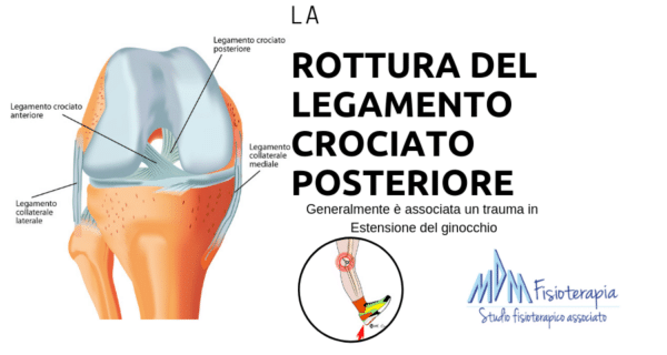 rottura legamento crociato posteriore