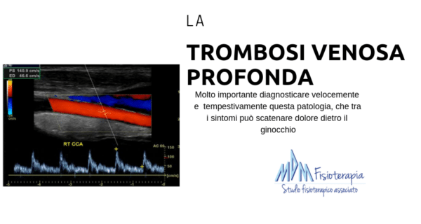 trombosi vernosa profonda