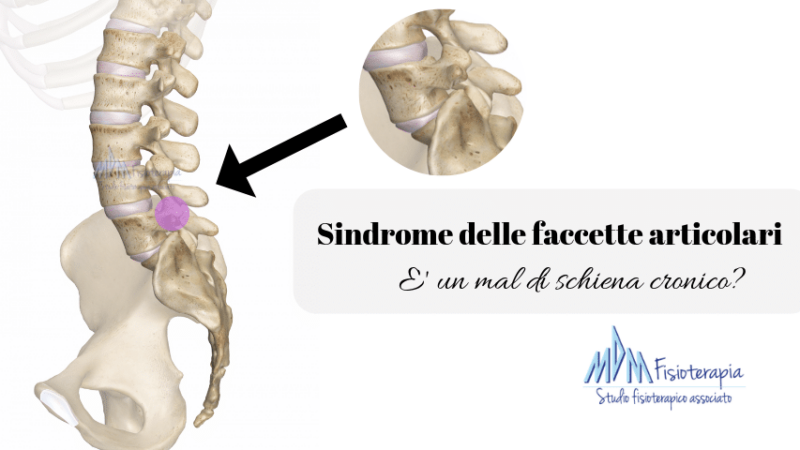 Sindrome delle faccette articolari | Quel mal di schiena che non passa