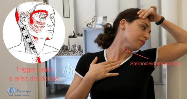 Sternocleidomastoideo e trigger point