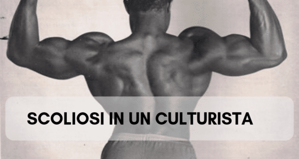 scoliosi in un culturista