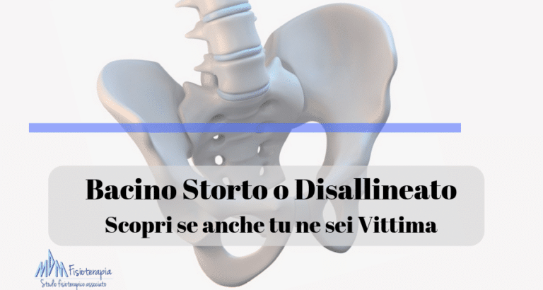 Bacino Storto o Disallineato | Scopri se anche tu ne sei Vittima