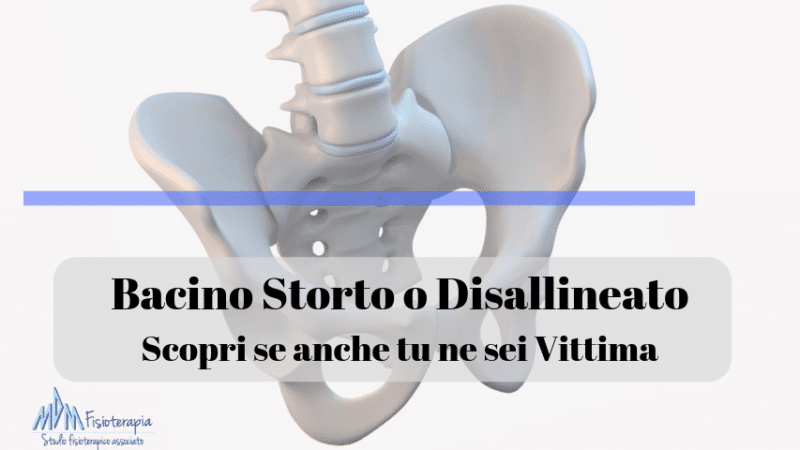 Bacino Storto o Disallineato | Scopri se anche tu ne sei Vittima