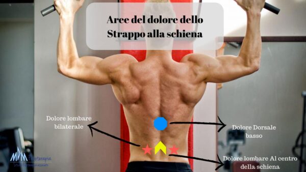 aree del dolore strappo alla schiena