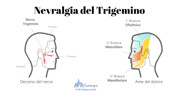 Infiammazione del Trigemino