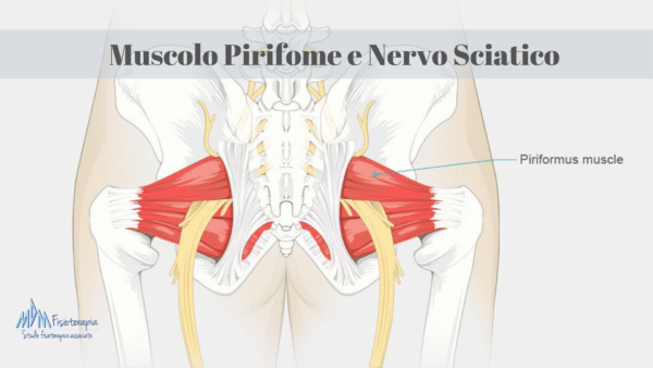 Falsa sciatica piriforme