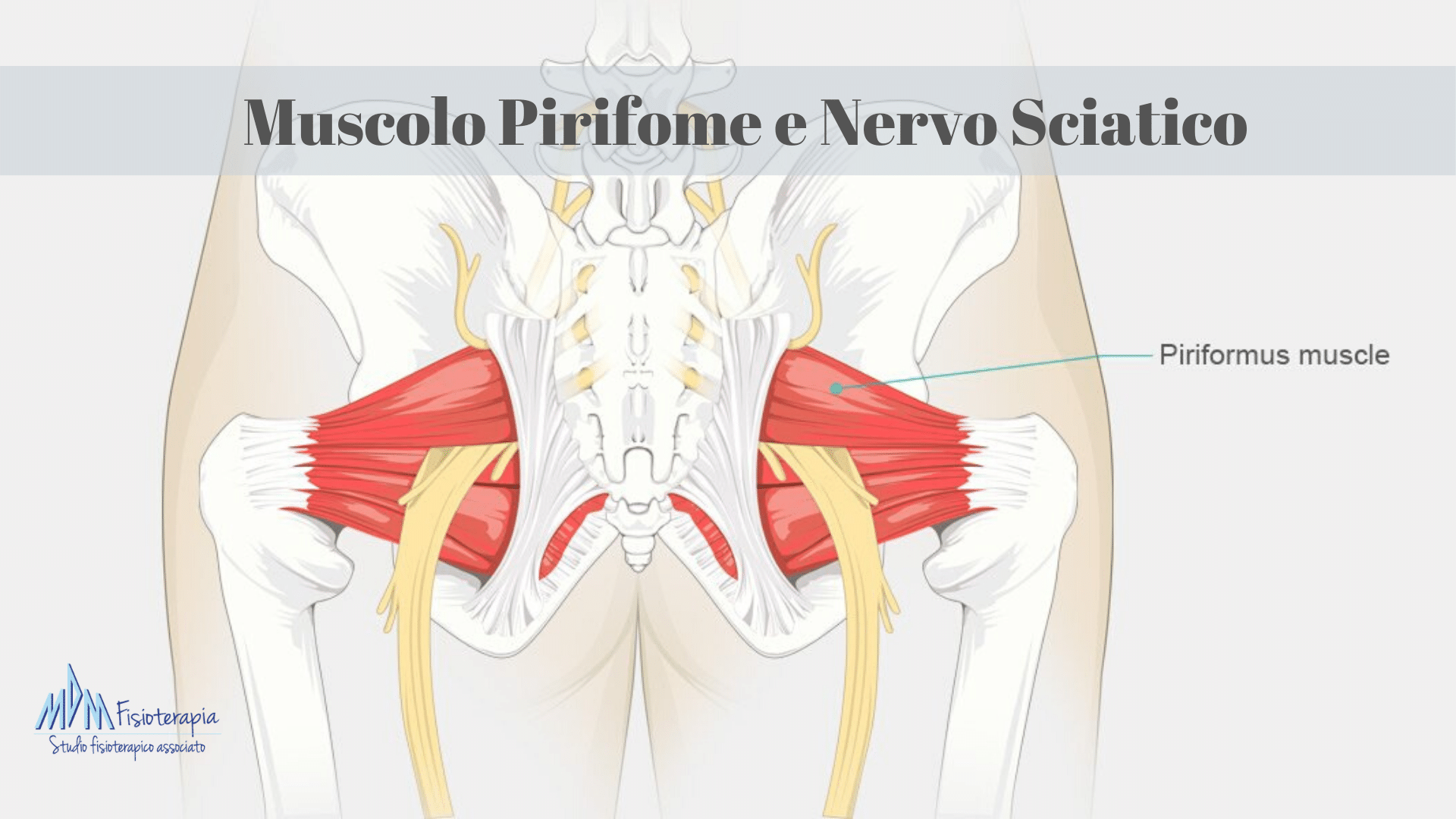 falsa sciatica piriforme