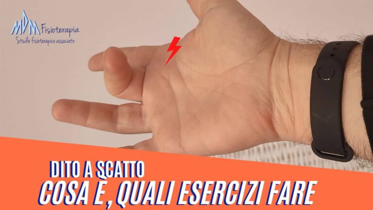 Dito a scatto riabilitazione | Come la Fisioterapia ci può aiutare