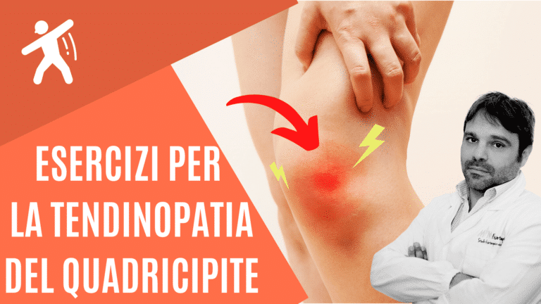 Esercizi per la Tendinite del quadricipite