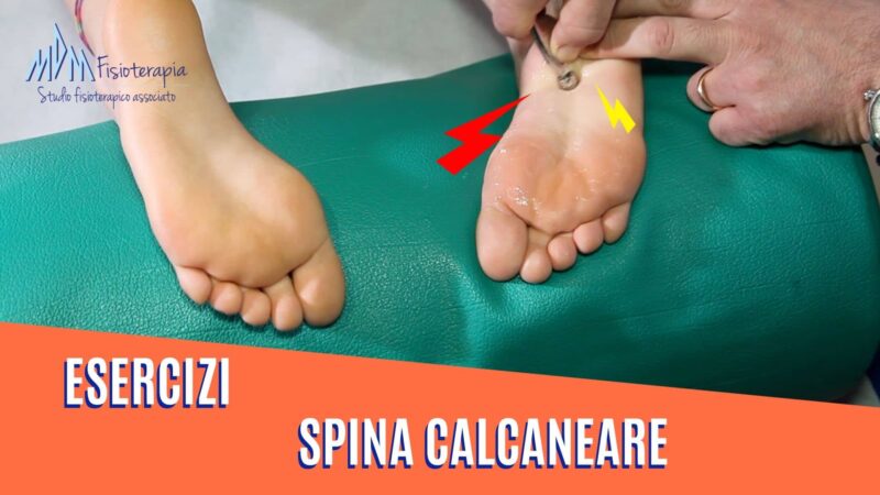 Esercizi spina calcaneare | Quali eseguire per eliminare il dolore