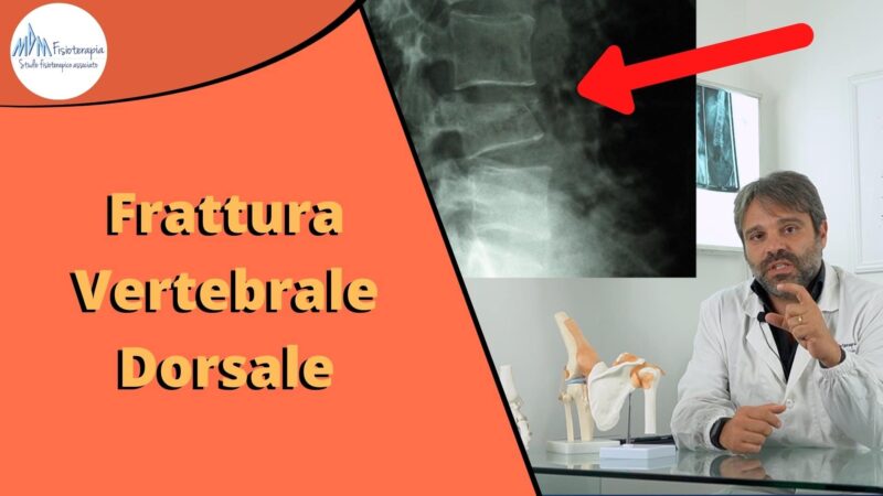 Frattura della dorsale | Fisioterapia e Riabilitazione per frattura vertebrale