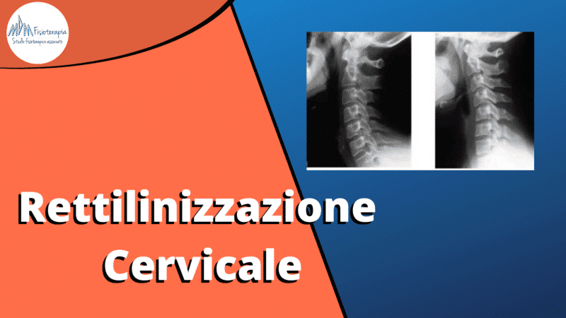 Rettilineizzazione della lordosi cervicale | Curare la perdita della fisiologica lordosi cervicale