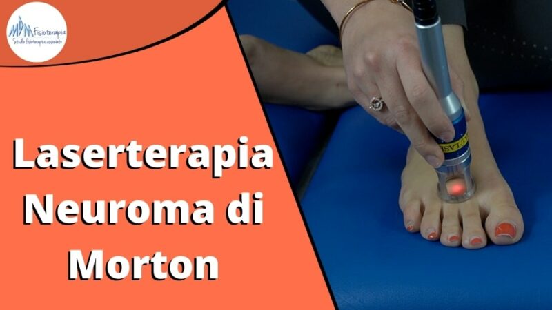 Laserterapia per Neuroma di Morton è la Soluzione Definitiva