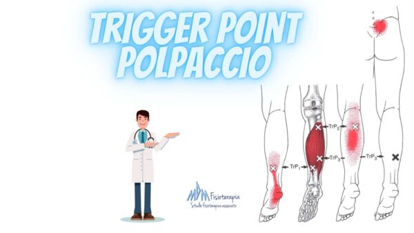 trigger point polpaccio